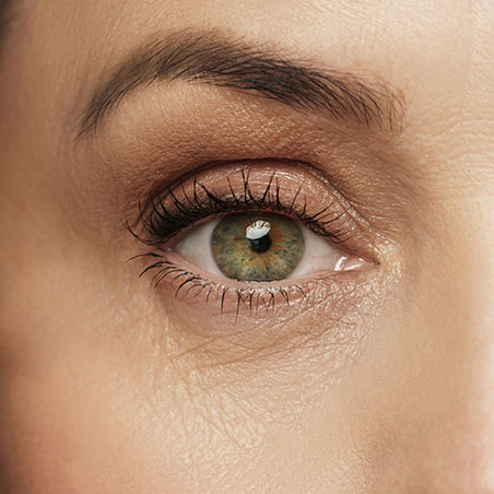 3123864-Tratamiento-de-ojeras