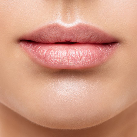 Aumento-de-labios-sin-cirugía